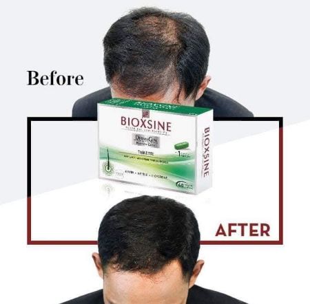 Image de la catégorie Cheveux