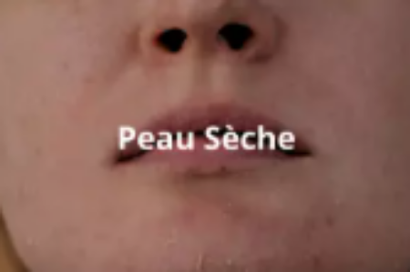 Image de la catégorie Peaux sèches